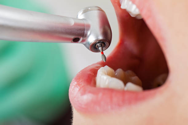 Best Pediatric Emergency Dentist in Pasadena Hills, MO